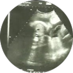 Profile photo of AVIELA GORDON