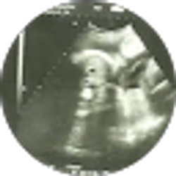 Profile photo of Aviela Gordon
