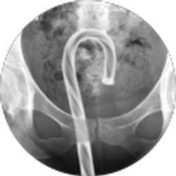 Profile photo of Pat Plesa