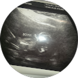 Profile photo of Kevin Townsend