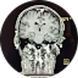 Profile photo of Tom Carter