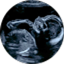 Profile photo of Jayden Barker